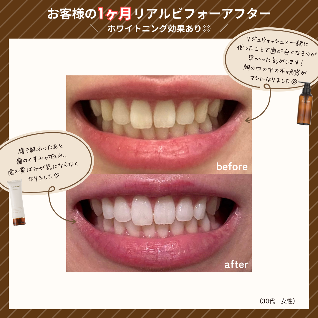 シルクドリバー リパーフェクト2箱 新品未使用 Reパーフェクト – シルクドリバー公式オンラインショップ