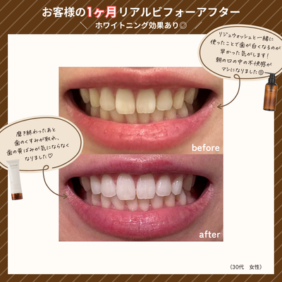 リジュフレッシュ (定期便)