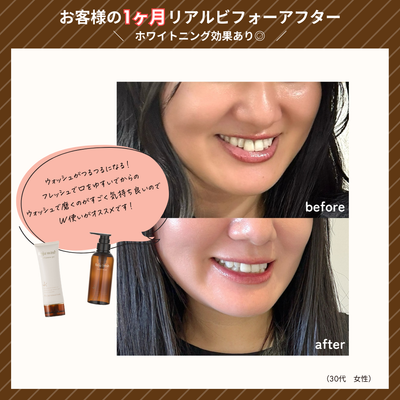 リジュフレッシュ (定期便)
