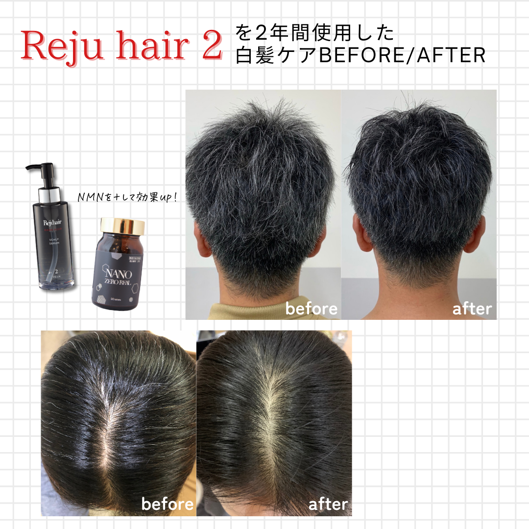 Reju hair ダークノアール スカルプセラム ≪2≫