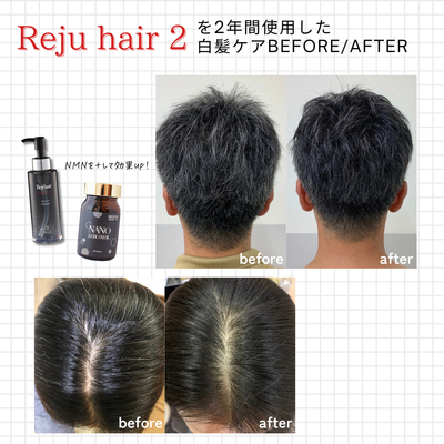 Reju hair ダークノアール スカルプセラム ≪2≫